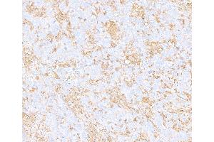Immunohistochemistry (IHC) image for anti-Cytoskeletal Actin (CIMG_00972) (AA 1-50) antibody (ABIN7449436) (Recombinant Cytoskeletal Actin (CIMG_00972) (AA 1-50) antibody)