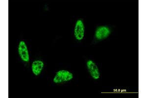 Immunofluorescence of monoclonal antibody to ALPK3 on HeLa cell. (ALPK3 antibody  (AA 1811-1906))