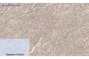 Immunohistochemical analysis of paraffin-embedded human uterus tissue. (Claudin 5 antibody  (AA 140-220))