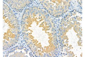 ABIN6259253 and ABIN6275428 at 1/100 staining Rat testis tissue by IHC-P. (PDXDC1 antibody  (C-Term))