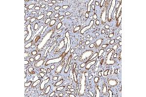IHC analysis of TRMT61A using anti-TRMT61A antibody (ABIN7599220). (TRMT61A antibody  (AA 1-289))