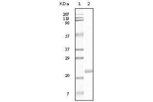 Western Blot showing EphB4 antibody used against truncated EphB4 recombinant protein.