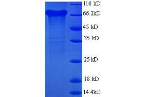 SDS-PAGE (SDS) image for Urease Subunit beta (AA 1-569), (full length) protein (His tag) (ABIN1047875) (Urease Subunit beta (AA 1-569), (full length) protein (His tag))