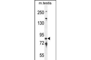 IFT81 antibody  (C-Term)