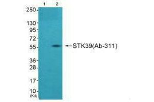 Western blot analysis of extracts from A549 cells using STK39 (Ab-311) antibody,The lane on the left is treated with synthesized peptide. (STK39 antibody  (Ser311))
