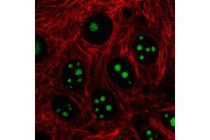 Immunofluorescent staining of MCF7 cells with MKI67IP monoclonal antibody, clone CL2240  (Green) shows specific nucleoli. (NIFK antibody)