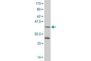 Western Blot detection against Immunogen (37. (NR4A2 antibody  (AA 147-250))