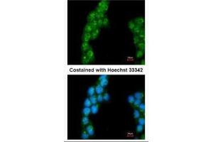 ICC/IF Image Immunofluorescence analysis of methanol-fixed A431, using Proteasome 26S S3, antibody at 1:200 dilution. (Proteasome 26S S3 (Center) antibody)
