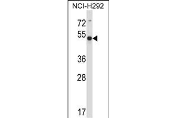 ACTR6 Antikörper  (C-Term)
