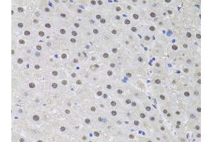Immunohistochemistry of paraffin-embedded rat liver using HUS1 antibody (ABIN6131776, ABIN6142084, ABIN6142086 and ABIN6218116) at dilution of 1:100 (40x lens). (HUS1 antibody  (AA 1-280))