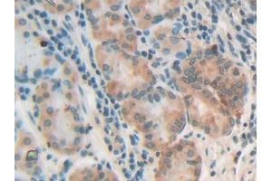 DAB staining on IHC-P; Samples: Human Stomach Tissue (NG2 antibody  (AA 1705-1942))