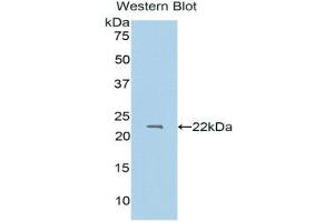 Western Blotting (WB) image for anti-Protein S (PROS) (AA 301-476) antibody (ABIN1175271) (PROS1 antibody  (AA 301-476))