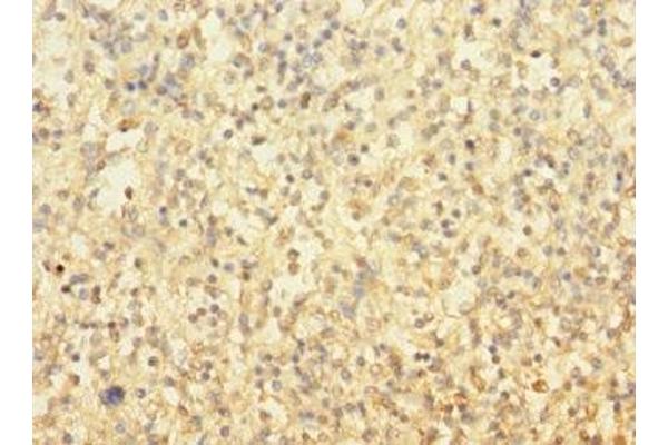 TUBAL3 antibody  (AA 1-300)