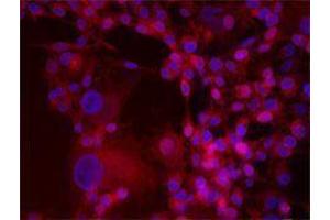 Immunofluorescence (IF) image for anti-Integrin beta 3 (ITGB3) antibody (Alexa Fluor 647) (ABIN2657832) (Integrin beta 3 antibody  (Alexa Fluor 647))