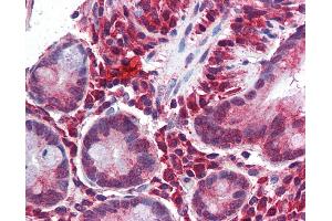 Immunohistochemistry (IHC) image for anti-Matrix Gla Protein (MGP) (Middle Region) antibody (ABIN2784506) (MGP antibody  (Middle Region))