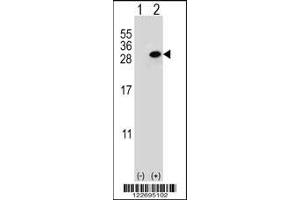 Western blot analysis of CLTA using rabbit polyclonal CLTA Antibody using 293 cell lysates (2 ug/lane) either nontransfected (Lane 1) or transiently transfected (Lane 2) with the CLTA gene.