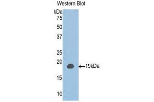 Western Blotting (WB) image for anti-Chloride Intracellular Channel 4 (CLIC4) (AA 104-253) antibody (ABIN1077929)