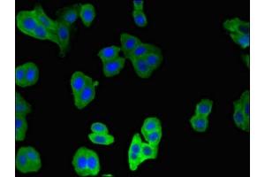 Immunofluorescent analysis of HepG2 cells using ABIN7146555 at dilution of 1:100 and Alexa Fluor 488-congugated AffiniPure Goat Anti-Rabbit IgG(H+L) (CNN2 antibody  (AA 2-309))