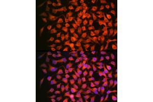 Immunofluorescence analysis of HeLa using RARβ Rabbit mAb (ABIN7269947) at dilution of 1:100 (40x lens). (Retinoic Acid Receptor beta antibody)