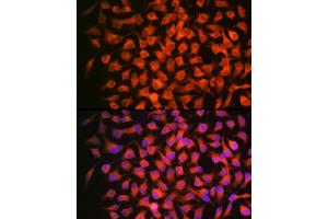 Immunofluorescence analysis of HeLa using RARβ Rabbit mAb (ABIN7269947) at dilution of 1:100 (40x lens). (Retinoic Acid Receptor beta antibody)