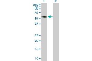 Western Blot analysis of ILDR1 expression in transfected 293T cell line ( H00286676-T02 ) by ILDR1 MaxPab polyclonal antibody. (ILDR1 antibody  (AA 1-502))