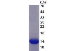 SDS-PAGE analysis of Human Semaphorin 5B Protein. (SEMA5B Protein)
