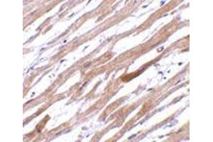 Immunohistochemistry of TIRAP in human heart tissue with this product at 20 μg/ml. (TIRAP antibody  (Center))