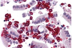 Human Small Intestine: Formalin-Fixed, Paraffin-Embedded (FFPE) (CHORDC1 antibody  (N-Term))