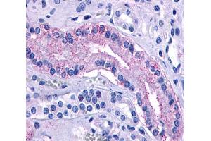 Anti-AVPR2 antibody  ABIN1048335 IHC staining of human kidney, renal tubules. (AVPR2 antibody  (Cytoplasmic Domain))