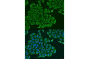 Immunofluorescence analysis of U2OS cells using ANXA7 antibody (ABIN1870994) at dilution of 1:100. (Annexin VII antibody)