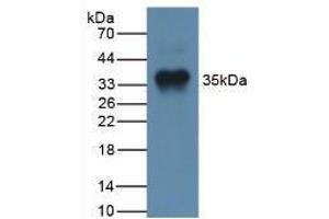 Western blot analysis of Human Liver Tissue. (MSTN antibody  (AA 266-375))
