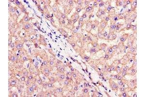 Immunohistochemistry (IHC) image for anti-Cell Death-Inducing DFFA-Like Effector A (CIDEA) (AA 1-51) antibody (ABIN7147273)