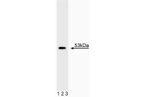 Western blot analysis of p53. (p53 antibody)