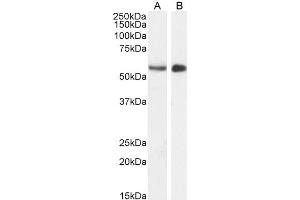 ABIN185178 (1µg/ml) staining of Mouse (A) and (2ug/ml) Pig (B) Testes lysate (35µg protein in RIPA buffer). (STK35 antibody  (C-Term))