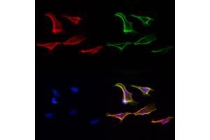 ABIN6265225 and ABIN6277101 staining Hela cells by IF/ICC. (SORD antibody  (Internal Region))