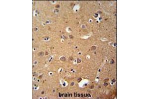 Immunohistochemistry (IHC) image for anti-Zinc Finger, DHHC-Type Containing 2 (ZDHHC2) (AA 77-106), (N-Term) antibody (ABIN5538359)
