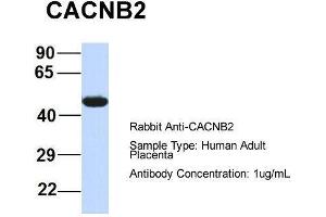 Host:  Rabbit  Target Name:  CACNB2  Sample Type:  Human Adult Placenta  Antibody Dilution:  1. (CACNB4 antibody  (Middle Region))