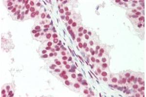 Human, Prostate: Formalin-Fixed Paraffin-Embedded (FFPE) (CTBP1 antibody  (C-Term))
