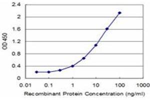 Detection limit for recombinant GST tagged CPA1 is approximately 0. (CPA1 antibody  (AA 1-419))