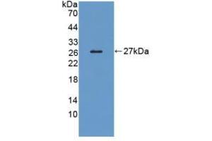 Figure. (LRP1B antibody  (AA 31-194))