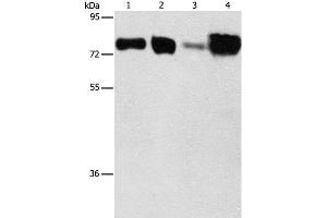 Western Blot analysis of Hepg2 and hela cell, Human fetal kidney and liver tissue using ACSL4 Polyclonal Antibody at dilution of 1:650 (ACSL4 antibody)