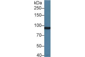 Western Blot; Sample: Rat Cerebrum lysate; Primary Ab: 1µg/ml Rabbit Anti-Human GRM3 Antibody Second Ab: 0. (Metabotropic Glutamate Receptor 3 antibody  (AA 568-819))