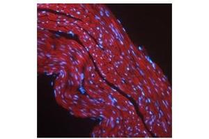 IGF1R antibody used at a concentration of 2-10 ug/ml to detect mouse skeletal muscle (red). (IGF1R antibody  (Middle Region))