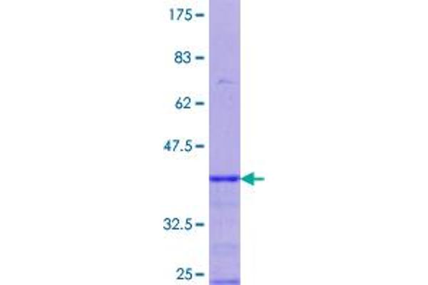 PGRMC1 Protein (AA 96-195) (GST tag)