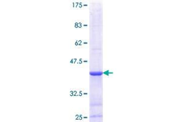 DGAT2 Protein (AA 289-388) (GST tag)