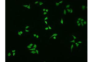 Immunofluorescence staining of HepG2 cells with ABIN7161520 at 1:100, counter-stained with DAPI. (NFKBIA antibody  (AA 27-317))