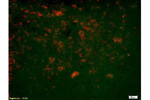 Formalin-fixed and paraffin-embedded rat brain labeled with Anti-Ninein/GSK3B interacting protein Polyclonal Antibody, Unconjugated (ABIN872552) 1:200, overnight at 4°C, The secondary antibody was Goat Anti-Rabbit IgG, Cy3 conjugated used at 1:200 dilution for 40 minutes at 37°C.