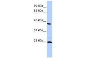 Image no. 1 for anti-Proteasome (Prosome, Macropain) Subunit, beta Type 2 (PSMB2) (AA 107-156) antibody (ABIN6741387) (PSMB2 antibody  (AA 107-156))