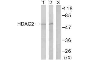 Western blot analysis of extracts from HeLa cells (Lane 1) and 293 cells (Lane 2 and 3), using HDAC2 (Ab-394) antibody (E021140). (HDAC2 antibody)