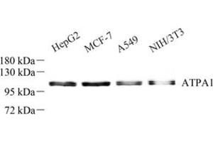 Western blot analysis of Sodium Potassium (ABIN7073154) at dilution of 1: 500 (ATPase (Na/K) antibody)